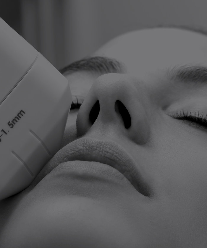 Laser and IPL treatment